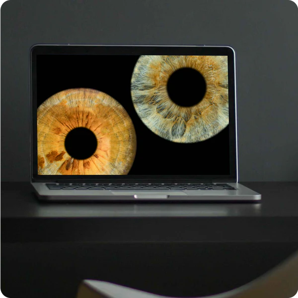 Digital iris file on smartphone screen